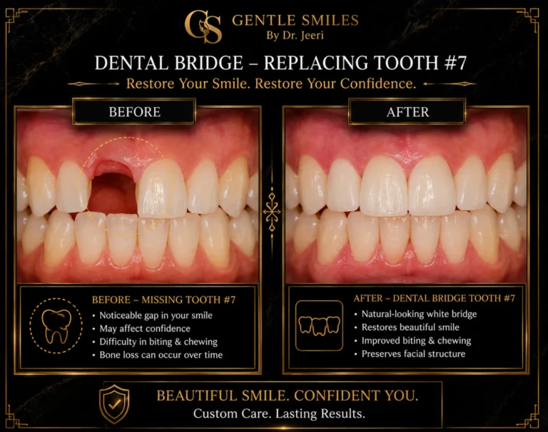 Dental bridge replacing tooth 7 before and after closing a visible front tooth gap in Cherry Hill, NJ