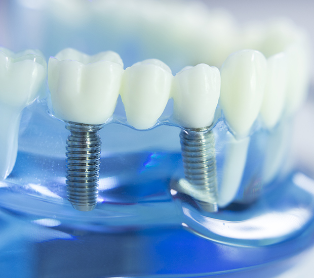 Cherry Hill Dental Implants
