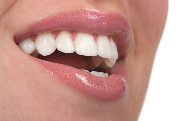 Smile Makeover: Different Types Of Veneers